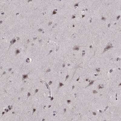 Immunohistochemistry: beta-Arrestin 1 Antibody [NBP2-68897]