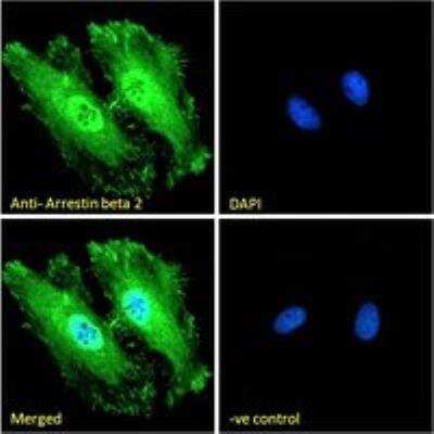 Immunocytochemistry/ Immunofluorescence: beta-Arrestin 2 Antibody [NB100-1515]