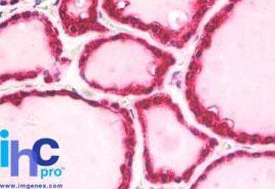 Immunohistochemistry-Paraffin: beta-Arrestin 2 Antibody - BSA Free [NBP2-24569]