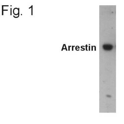 Western Blot: beta-Arrestin 2 Antibody [NB300-587]