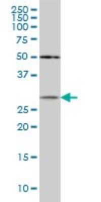 Western Blot: beta B1 Crystallin Antibody (3D9) [H00001414-M03]