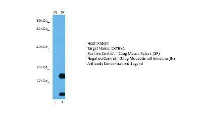 Western Blot: beta B1 Crystallin Antibody [NBP2-87073]