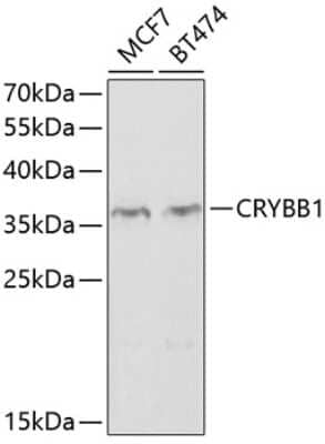 Western Blot: beta B1 Crystallin AntibodyBSA Free [NBP2-92412]