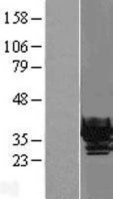 Western Blot: beta B1 Crystallin Overexpression Lysate [NBL1-09499]