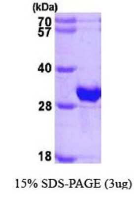 SDS-PAGE: Recombinant Human beta B1 Crystallin His Protein [NBP1-44470]