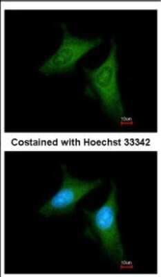 Immunocytochemistry/ Immunofluorescence: beta COP Antibody [NBP2-15579]