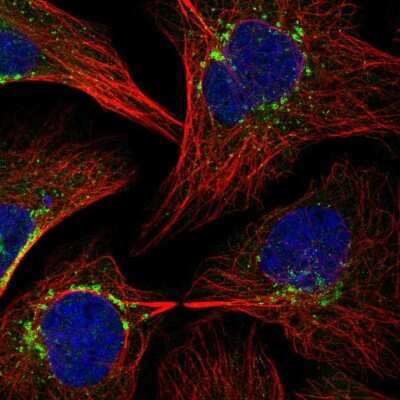 Immunocytochemistry/ Immunofluorescence: beta COP Antibody [NBP2-38519]