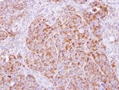 Immunohistochemistry-Paraffin: beta COP Antibody [NBP2-15578]