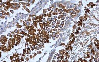 Immunohistochemistry-Paraffin: beta COP Antibody [NBP2-15578]