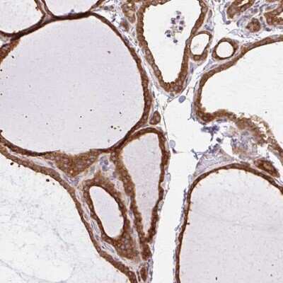 Immunohistochemistry-Paraffin: beta COP Antibody [NBP2-38519]