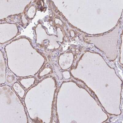Immunohistochemistry-Paraffin: beta COP Antibody [NBP2-39027]