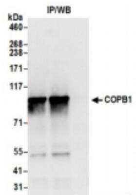 Immunoprecipitation: beta COP Antibody [NBP2-41358]