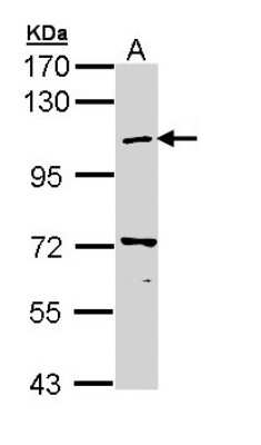 Western Blot: beta COP Antibody [NBP2-15579]