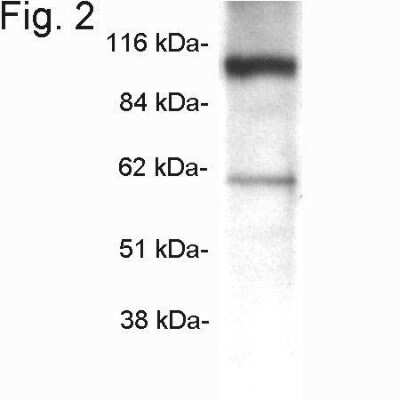 Western Blot: beta COP Antibody [NBP2-22544]