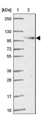 Western Blot: beta COP Antibody [NBP2-39027]
