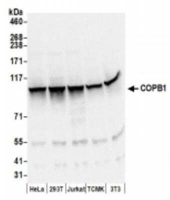 Western Blot: beta COP Antibody [NBP2-41358]