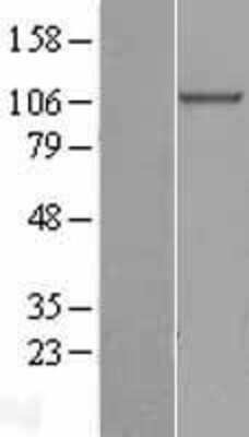 Western Blot: beta COP Overexpression Lysate [NBL1-09377]