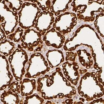 Immunohistochemistry-Paraffin: beta Casein Antibody [NBP1-88188]