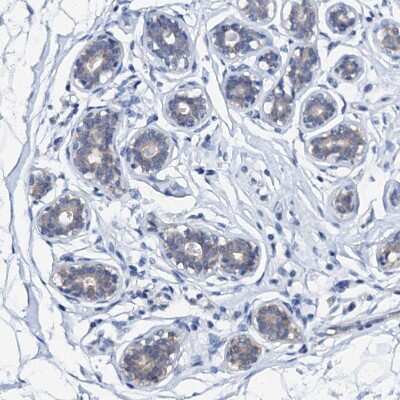 Immunohistochemistry-Paraffin: beta Casein Antibody [NBP1-88188]