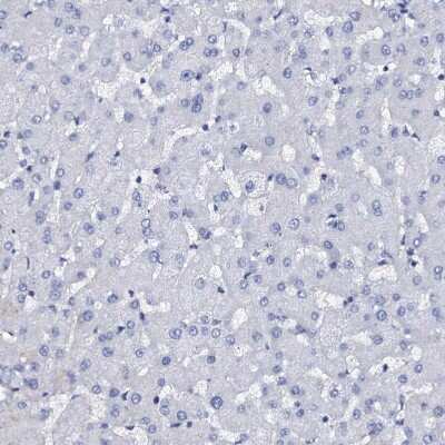 Immunohistochemistry-Paraffin: beta Casein Antibody [NBP1-88188]