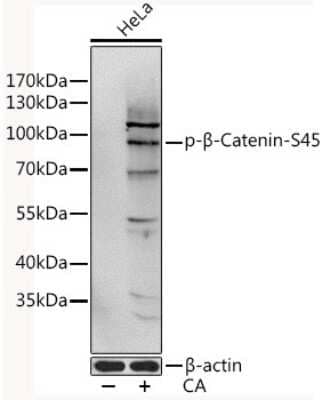 Western Blot: beta-Catenin [p Ser45] AntibodyAzide and BSA Free [NBP3-05442]