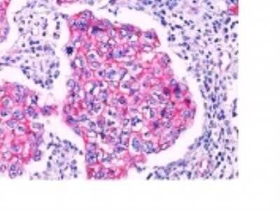 Immunohistochemistry-Paraffin: beta-Catenin Antibody - BSA Free [NBP2-33124]