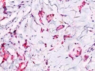 Immunohistochemistry-Paraffin: beta-Catenin Antibody - BSA Free [NBP2-33124]