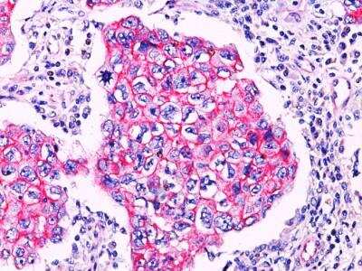 Immunohistochemistry-Paraffin: beta-Catenin Antibody - IHC-Prediluted [NBP2-48367]