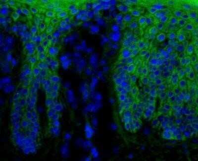 Immunohistochemistry: beta-Catenin Antibody (12F7) - Azide and BSA Free [NBP2-80596]