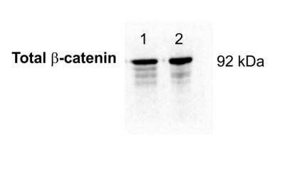 Western Blot: beta-Catenin Antibody (12F7)Azide and BSA Free [NBP2-80596]