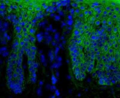 Immunohistochemistry: beta-Catenin Antibody (12F7) - BSA Free [NBP1-54467]