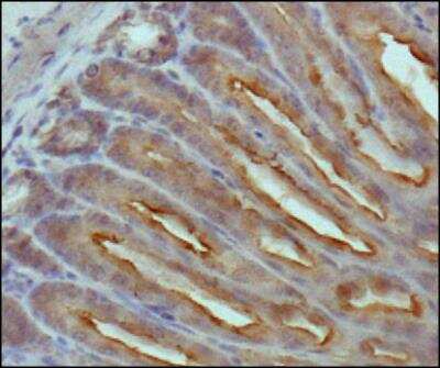 Immunohistochemistry-Paraffin: beta-Catenin Antibody (12F7) - BSA Free [NBP1-54467]