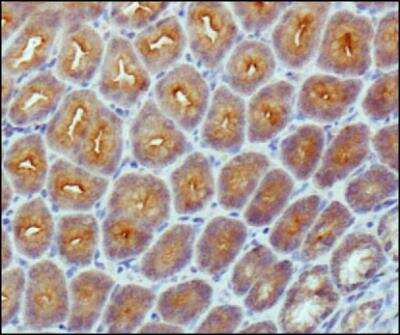 Immunohistochemistry-Paraffin: beta-Catenin Antibody (12F7) - BSA Free [NBP1-54467]