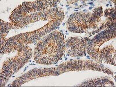 Immunohistochemistry-Paraffin: beta-Catenin Antibody (OTI12H7) [NBP2-03615]