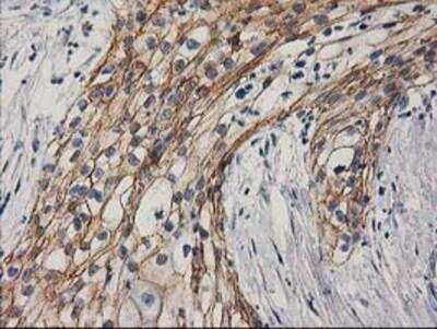 Immunohistochemistry-Paraffin: beta-Catenin Antibody (OTI12H7) [NBP2-03615]