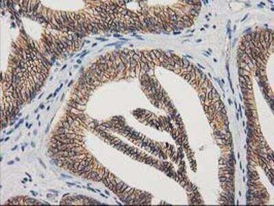 Immunohistochemistry-Paraffin: beta-Catenin Antibody (OTI12H7) [NBP2-03615]