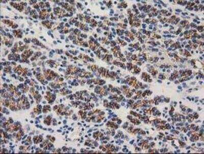 Immunohistochemistry-Paraffin: beta-Catenin Antibody (OTI12H7) [NBP2-03615]