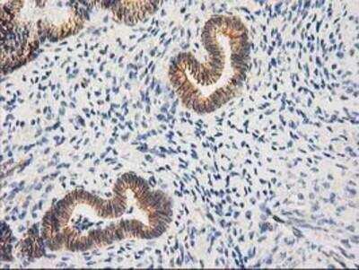 Immunohistochemistry-Paraffin: beta-Catenin Antibody (OTI12H7) [NBP2-03615]