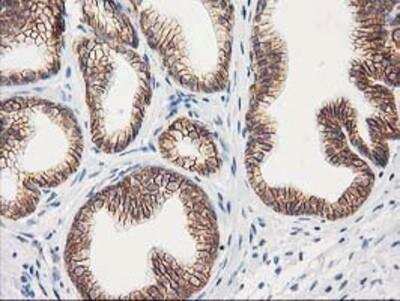 Immunohistochemistry-Paraffin: beta-Catenin Antibody (OTI12H7) [NBP2-03615]