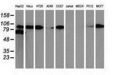 Western Blot: beta-Catenin Antibody (OTI12H7) [NBP2-03615]