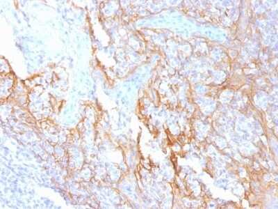 Immunohistochemistry-Paraffin: beta-Catenin Antibody (15B8) [NBP2-53358]