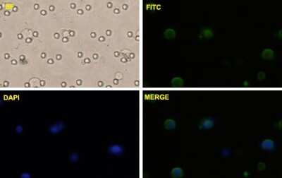 Immunocytochemistry/ Immunofluorescence: beta-Catenin Antibody (1C9) [H00001499-M02]