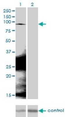 Western Blot: beta-Catenin Antibody (1C9) [H00001499-M02]