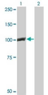 Western Blot: beta-Catenin Antibody (1C9) [H00001499-M02]