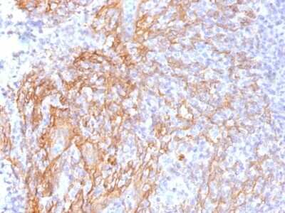 Immunohistochemistry-Paraffin: beta-Catenin Antibody (6F9) - Azide and BSA Free [NBP2-54543]