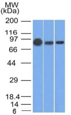 Western Blot: beta-Catenin Antibody (9F2) [NBP2-53257]