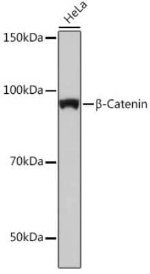 Western Blot: beta-Catenin Antibody (6A3P2) [NBP3-15842]