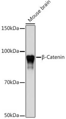 Western Blot: beta-Catenin Antibody (6A3P2) [NBP3-15842]