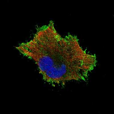 Immunocytochemistry/ Immunofluorescence: beta-Catenin Antibody (CL3689) [NBP2-61628]