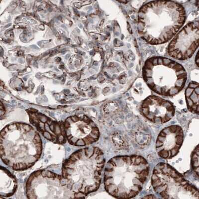 Immunohistochemistry: beta-Catenin Antibody (CL3689) [NBP2-61628]
